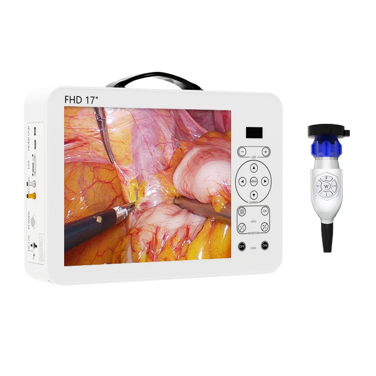 Sistema de Diagnóstico ORL con - Medical Lab Images reseña y precio